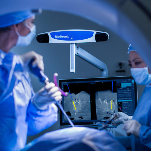 Neurosurgical navigation